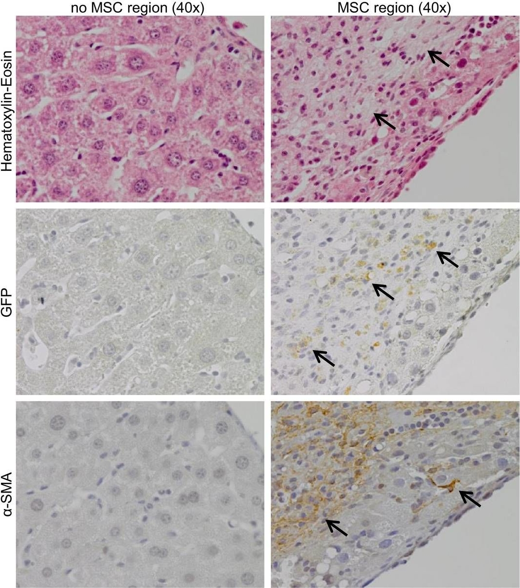 Local but not systemic administration of mesenchymal stromal cells ameliorates fibrogenesis in regenerating livers.