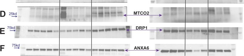 Fig.4.D showing Western Blotting from the publication: The D2.B10-Dmdmdx/J Mouse Model of Duchenne Muscular Dystrophy Exhibits a Severe Mitochondrial Deficiency Not Observed in the C57BL/10ScSn-Dmdmdx/J Mouse.