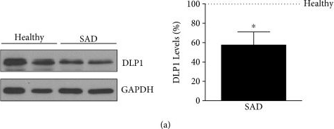Fig.2.A showing Western Blotting in a Mus musculus (House mouse) sample from the publication: Slower Dynamics and Aged Mitochondria in Sporadic Alzheimer's Disease.
