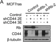 Fig.4.A showing Western Blotting from the publication: Rb suppresses collective invasion, circulation and metastasis of breast cancer cells in CD44-dependent manner.