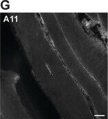 Fig.9.G showing Immunohistochemistry-immunofluorescence in a Homo sapiens (Human) sample from the publication: C-terminal extension of HSPB6 in a family with myopathy and cataract.