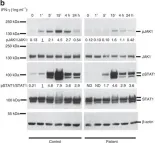 Fig.5.B showing Western Blotting from the publication: Biallelic JAK1 mutations in immunodeficient patient with mycobacterial infection.