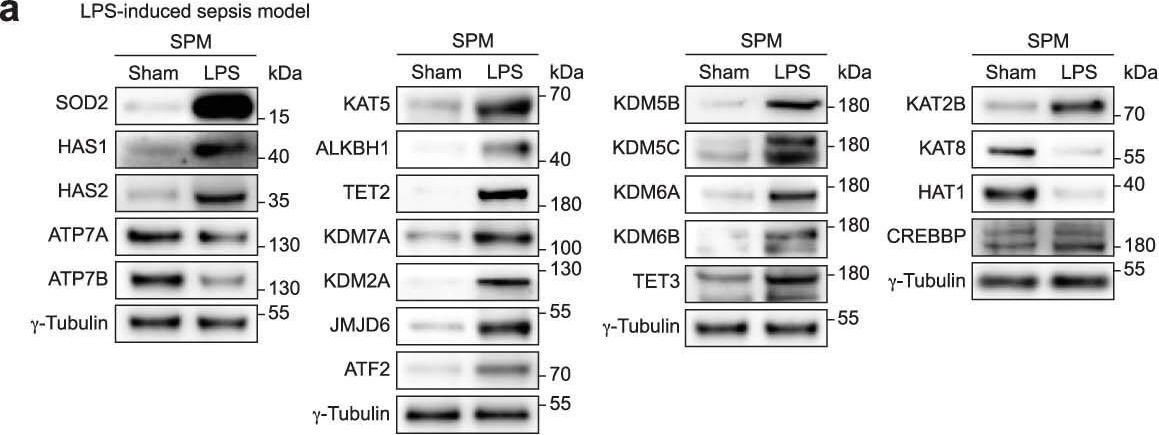 Fig.10.A showing Western Blotting in a Homo sapiens (Human) sample from the publication: A druggable copper-signalling pathway that drives inflammation.