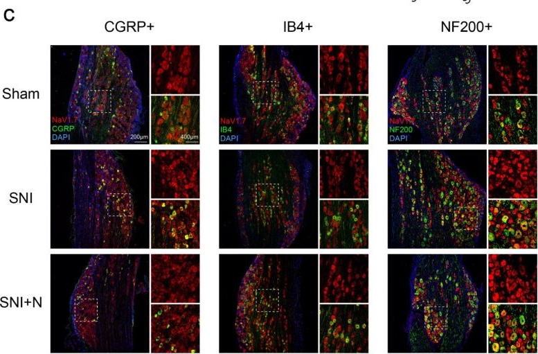 Fig.8.C showing Immunohistochemistry-immunofluorescence from the publication: Reversal of Peripheral Neuropathic Pain by the Small-Molecule Natural Product Narirutin via Block of Nav1.7 Voltage-Gated Sodium Channel.