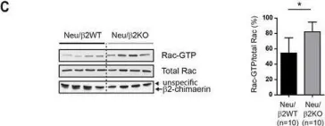 Fig.7.C showing Western Blotting from the publication: A new role of the Rac-GAP β2-chimaerin in cell adhesion reveals opposite functions in breast cancer initiation and tumor progression.
