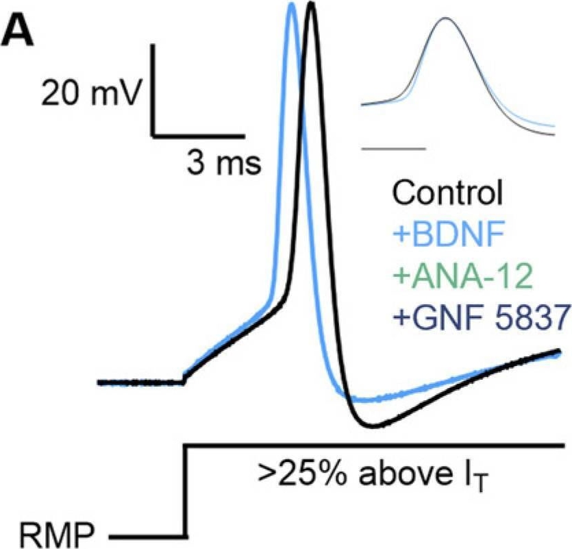 Fig.8.A from the publication: BDNF Differentially Affects Low- and High-Frequency Neurons in a Primary Nucleus of the Chicken Auditory Brainstem.