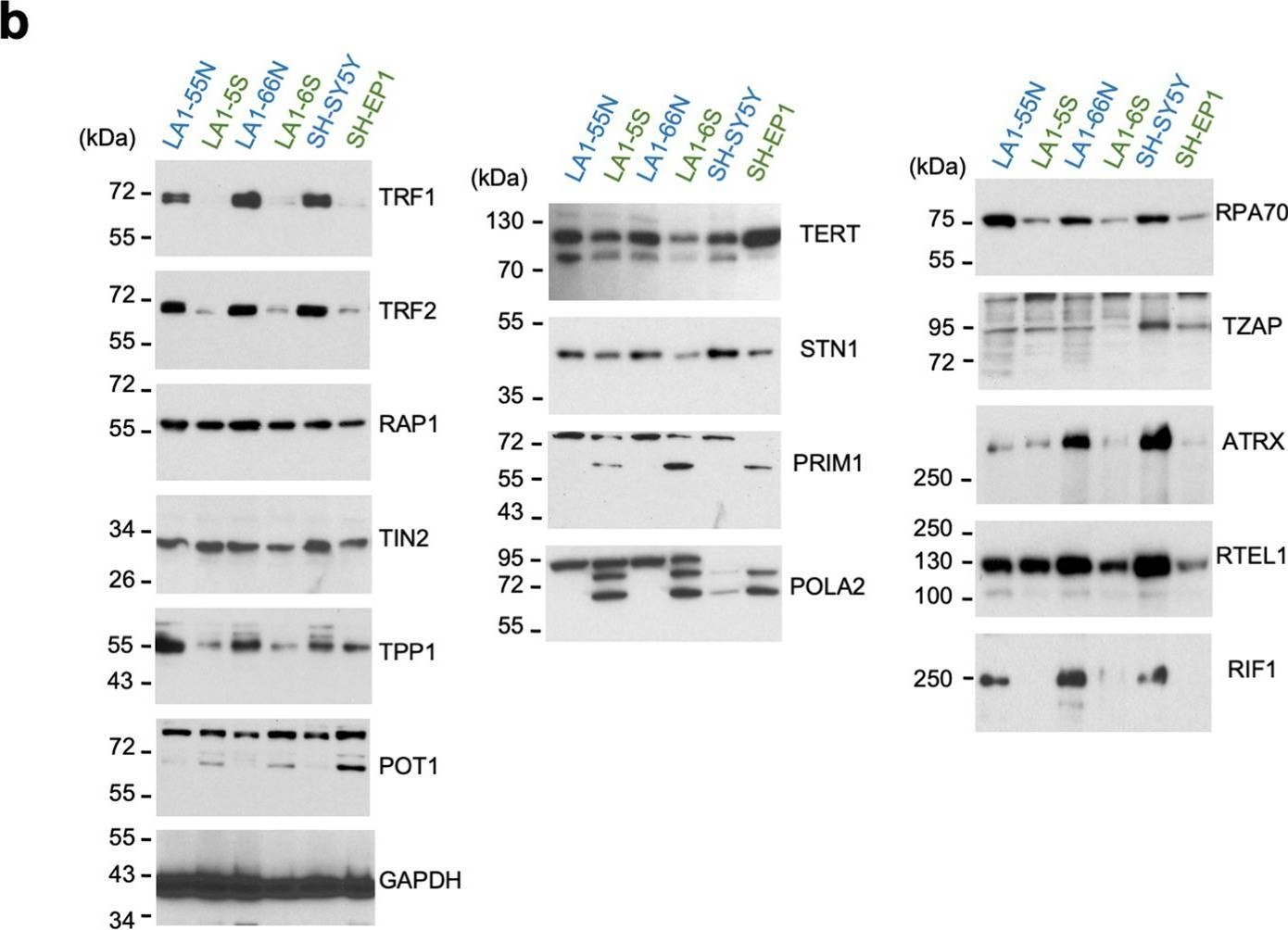 Fig.1.B showing Western Blotting from the publication: Reciprocal impacts of telomerase activity and ADRN/MES differentiation state in neuroblastoma tumor biology.