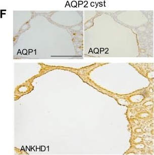 Fig.2.F showing Immunohistochemistry in a Mus musculus (House mouse) sample from the publication: ANKHD1 promotes pathogenic proliferation in Autosomal Dominant Polycystic Kidney Disease via the Cyclin D1/CDK4 pathway.