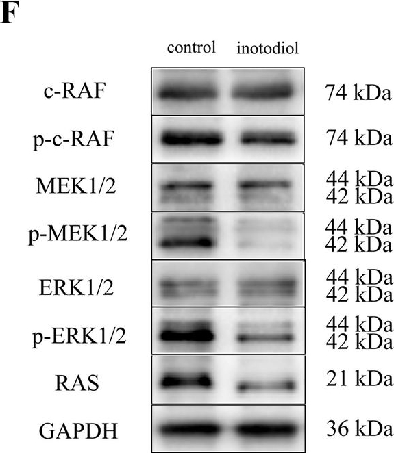 Fig.6.F showing Western Blotting from the publication: Inotodiol induces hepatocellular carcinoma apoptosis by activation of MAPK/ERK pathway.