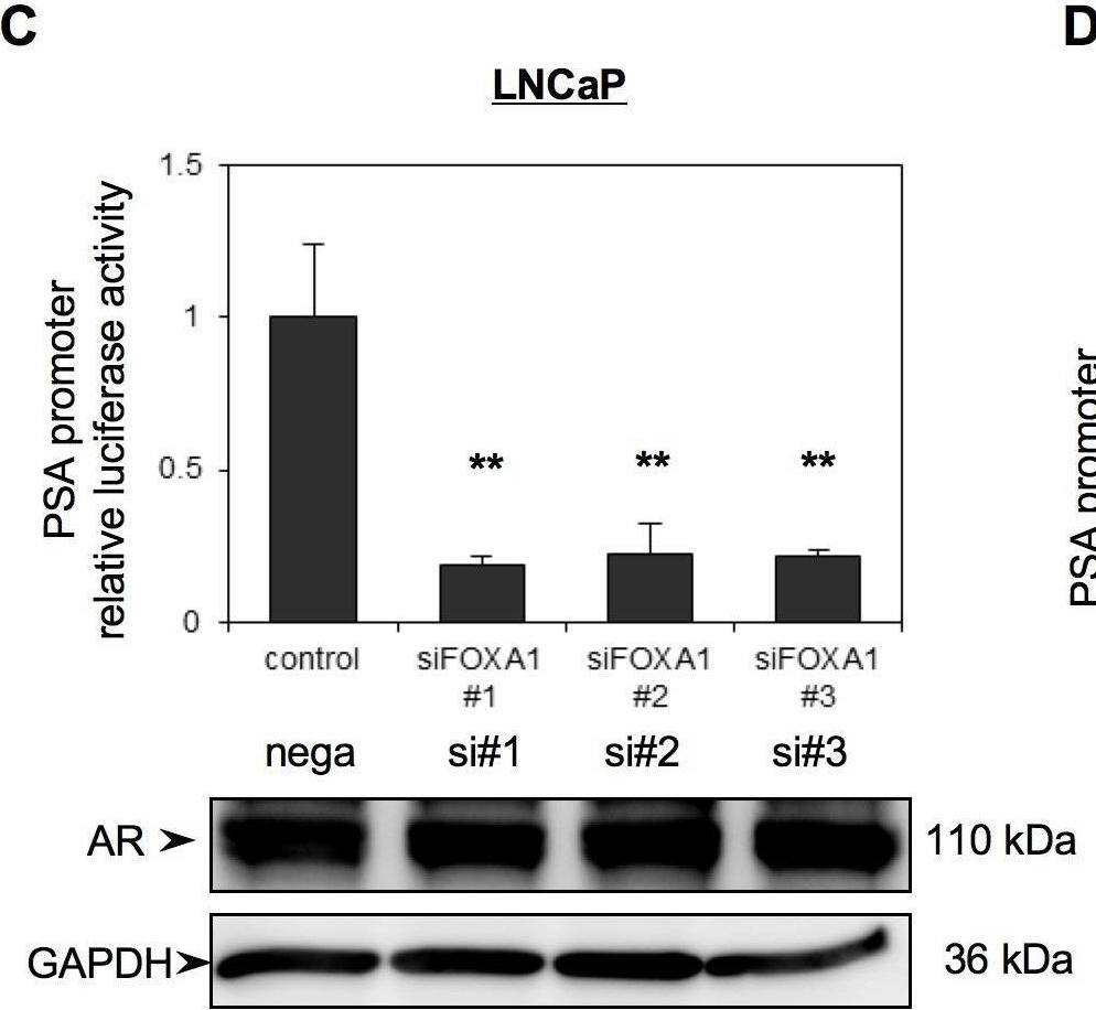 Fig.2.C showing Western Blotting in a Homo sapiens (Human) sample from the publication: FOXA1 promotes tumor progression in prostate cancer via the insulin-like growth factor binding protein 3 pathway.