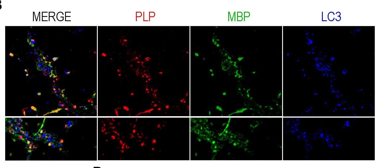 Fig.3.B showing Immunocytochemistry-immunofluorescence in a Mus musculus (House mouse) sample from the publication: Autophagic degradation of CNS myelin maintains axon integrity.