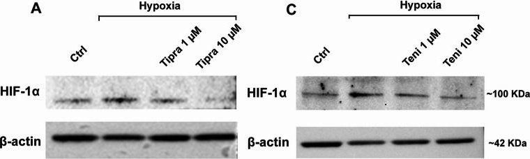 Fig.4.A showing Western Blotting in a Homo sapiens (Human) sample from the publication: Effects of New P2X7R Antagonists on Retinal Inflammatory Degenerative Conditions.