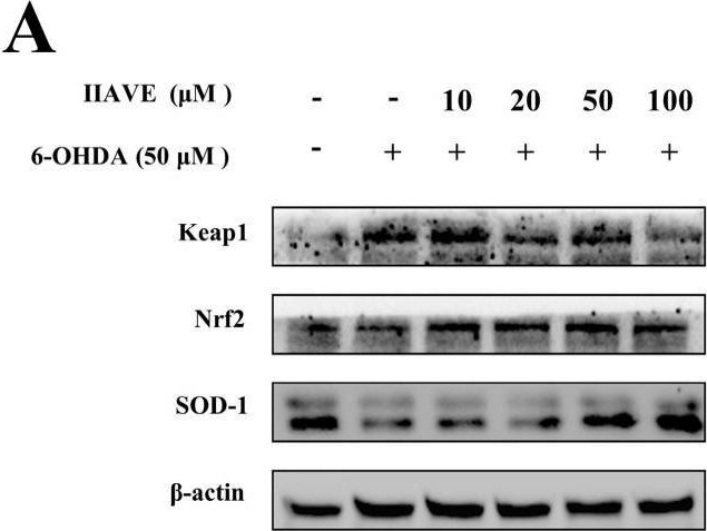 Fig.8.A showing Western Blotting in a Homo sapiens (Human) sample from the publication: Neuroprotection of Truncated Peptide IIAVE from Isochrysis zhanjiangensis: Quantum Chemical, Molecular Docking, and Bioactivity Studies.