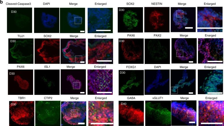 Fig.2.B showing Immunocytochemistry-immunofluorescence from the publication: Neurodevelopmental impairment induced by prenatal valproic acid exposure shown with the human cortical organoid-on-a-chip model.