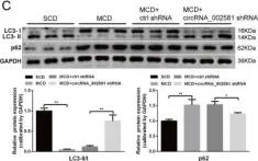 Fig.5.C showing Western Blotting from the publication: Antagonizing circRNA_002581-miR-122-CPEB1 axis alleviates NASH through restoring PTEN-AMPK-mTOR pathway regulated autophagy.