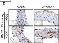 Fig.3.D showing Immunohistochemistry from the publication: The NRF2/ID2 Axis in Vascular Smooth Muscle Cells: Novel Insights into the Interplay between Vascular Calcification and Aging.