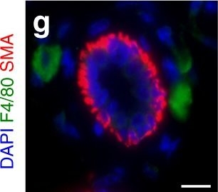 Macrophages orchestrate breast cancer early dissemination and metastasis.