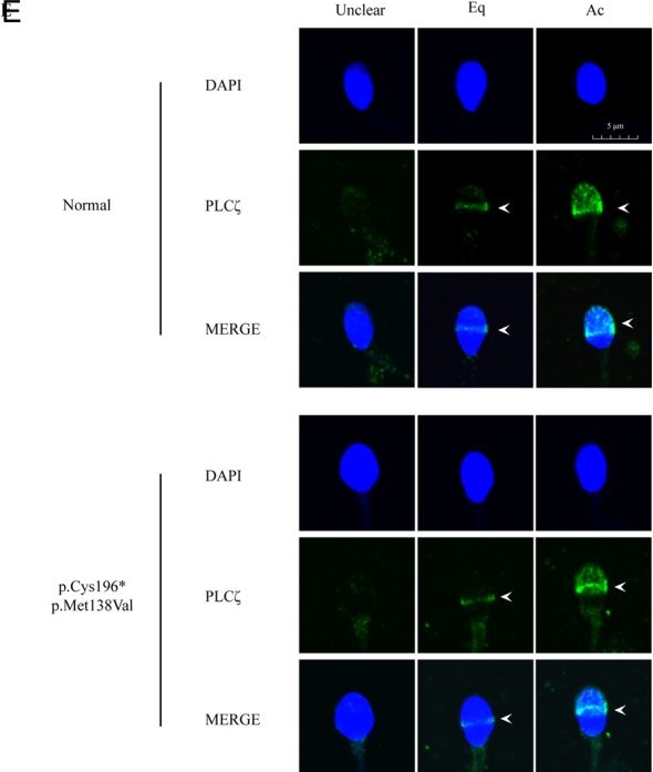 Fig.5.E showing Immunocytochemistry-immunofluorescence from the publication: Novel PLCZ1 compound heterozygous mutations indicate gene dosage effect involved in total fertilisation failure after ICSI.