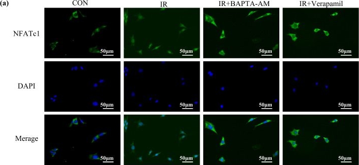 Fig.7.A showing Immunocytochemistry-immunofluorescence from the publication: Intracellular Calcium Overload Promotes NFATc1-ATF3 Activation and Induces the Senescence-Associated Phenotype in Irradiated Osteocytes.