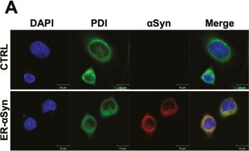 Fig.1.A showing Immunocytochemistry-immunofluorescence in a Rattus norvegicus (Rat) sample from the publication: Mesenchymal stem cells enhance selective ER-phagy to promote α-synuclein clearance in Parkinson's disease.
