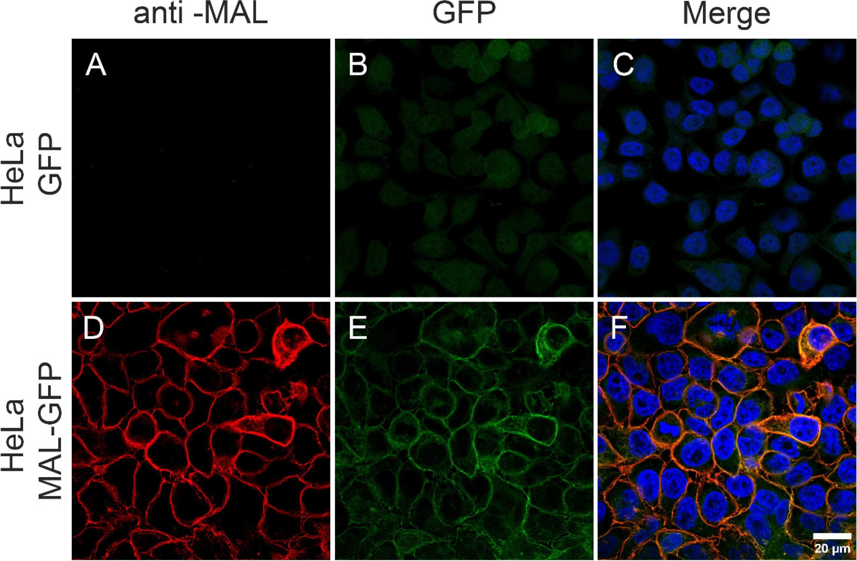 Fig.1.A showing Immunocytochemistry-immunofluorescence in a Homo sapiens (Human) sample from the publication: Epsilon Toxin from Clostridium perfringens Induces the Generation of Extracellular Vesicles in HeLa Cells Overexpressing Myelin and Lymphocyte Protein.