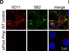 Fig.5.D showing Immunocytochemistry-immunofluorescence from the publication: Prion protein conversion at two distinct cellular sites precedes fibrillisation.