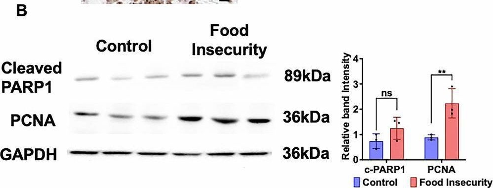 Fig.3.B showing Western Blotting in a Mus musculus (House mouse) sample from the publication: Food insecurity impacts neuroblastoma pathogenesis in murine xenograft tumor models.