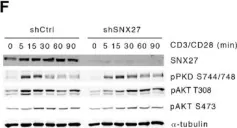 Fig.5.F showing Western Blotting in a Homo sapiens (Human) sample from the publication: SNX27 links DGKζ to the control of transcriptional and metabolic programs in T lymphocytes.