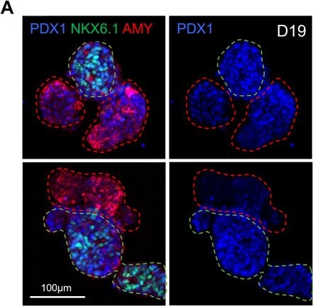 Fig.3.A showing Immunocytochemistry-immunofluorescence in a Homo sapiens (Human) sample from the publication: Generation of human iPSC-derived pancreatic organoids to study pancreas development and disease.