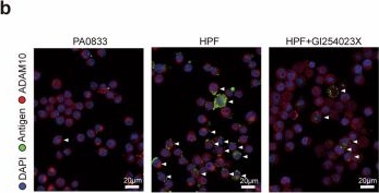 Fig.3.B showing Immunocytochemistry-immunofluorescence from the publication: Alpha hemolysin enhances the immune response by modulating dendritic cell differentiation via ADAM10-Notch signaling.