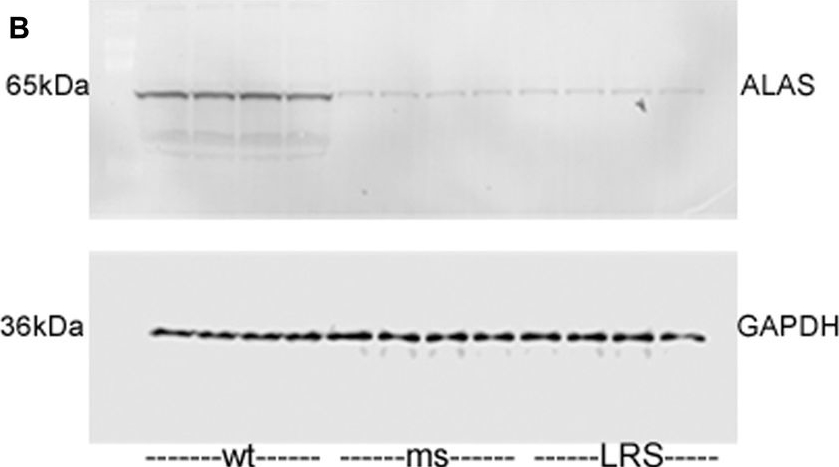 Fig.7.B showing Western Blotting in a Mus musculus (House mouse) sample from the publication: H-ferritin ferroxidase induces cytoprotective pathways and inhibits microvascular stasis in transgenic sickle mice.