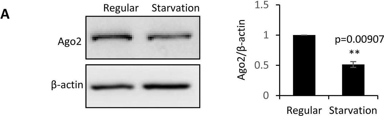 Fig.5.A showing Western Blotting from the publication: Starvation stress attenuates the miRNA-target interaction in suppressing breast cancer cell proliferation.