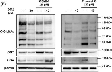 Fig.1.F showing Western Blotting from the publication: Dammarenediol II enhances etoposide-induced apoptosis by targeting O-GlcNAc transferase and Akt/GSK3β/mTOR signaling in liver cancer.
