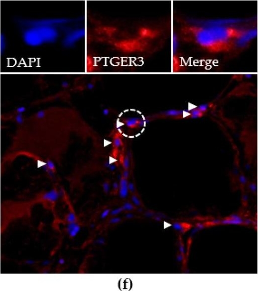 Fig.1.F showing Immunohistochemistry-immunofluorescence in a Homo sapiens (Human) sample from the publication: Unsaturated Long-Chain Fatty Acids Activate Resident Macrophages and Stem Cells in a Human Skeletal Muscle Tissue Model.