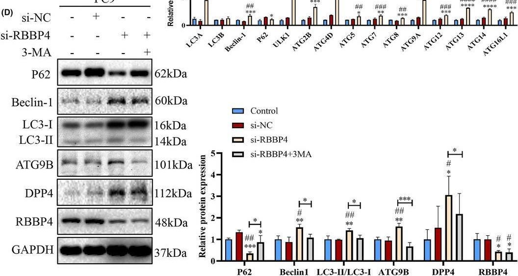 Fig.8.D showing Western Blotting in a Homo sapiens (Human) sample from the publication: RBBP4: A novel diagnostic and prognostic biomarker for non-small-cell lung cancer correlated with autophagic cell death.
