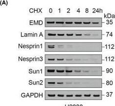 Fig.2.A showing Western Blotting in a Homo sapiens (Human) sample from the publication: ISGylation of EMD promotes its interaction with PDHA to inhibit aerobic oxidation in lung adenocarcinoma.
