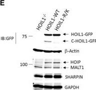 Fig.1.E showing Western Blotting from the publication: MALT1-Dependent Cleavage of HOIL1 Modulates Canonical NF-κB Signaling and Inflammatory Responsiveness.