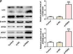 Fig.2.F showing Western Blotting in a Homo sapiens (Human) sample from the publication: Abrogating PDK4 activates autophagy-dependent ferroptosis in breast cancer via ASK1/JNK pathway.