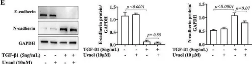 Fig.4.E showing Western Blotting in a Homo sapiens (Human) sample from the publication: Uvaol attenuates TGF-β1-induced epithelial-mesenchymal transition in human alveolar epithelial cells by modulating expression and membrane localization of β-catenin.