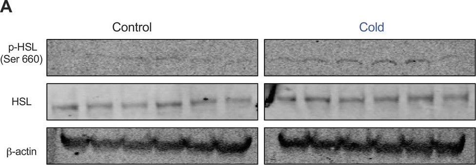 Fig.4.A showing Western Blotting in a Mus musculus (House mouse) sample from the publication: Cold induces brain region-selective cell activity-dependent lipid metabolism.