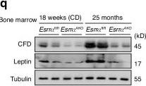 Fig.3.Q showing Western Blotting from the publication: Targeting adipocyte ESRRA alleviates osteoarthritis via interrupting inter-organelle crosstalk of complement C3-CFD-MAC cascade.