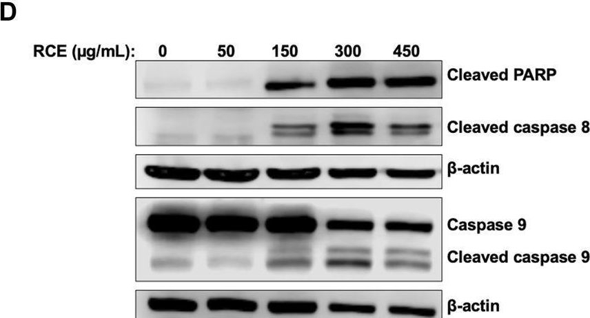 Fig.5.D showing Western Blotting in a Homo sapiens (Human) sample from the publication: Rhus coriaria induces autophagic and apoptotic cell death in pancreatic cancer cells.