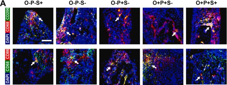 Fig.3.A showing Immunohistochemistry-immunofluorescence from the publication: Met@MPDA rejuvenates BMSC energy metabolism to promote bone regeneration in semaglutide-treated obese periodontitis.
