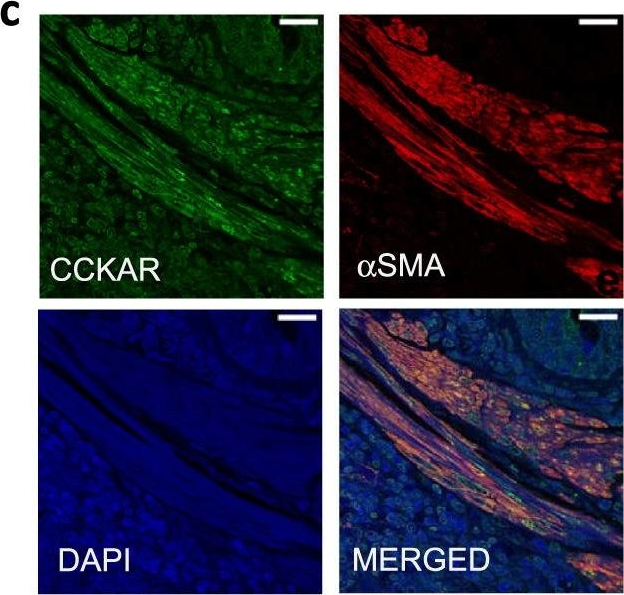 Fig.1.C showing Immunohistochemistry-immunofluorescence in a Mus musculus (House mouse) sample from the publication: Antagonizing cholecystokinin A receptor in the lung attenuates obesity-induced airway hyperresponsiveness.
