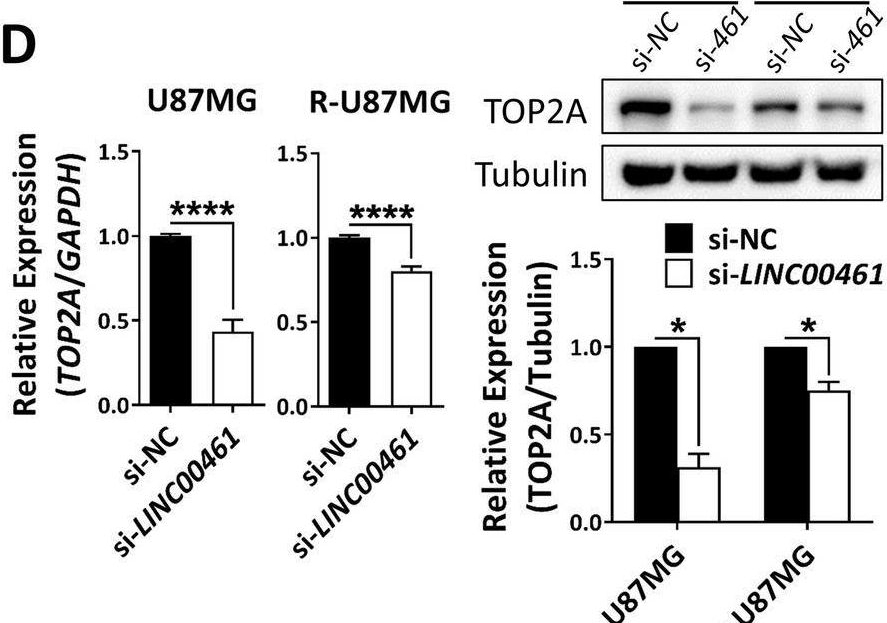 Fig.4.D showing Western Blotting from the publication: HDAC6 involves in regulating the lncRNA-microRNA-mRNA network to promote the proliferation of glioblastoma cells.