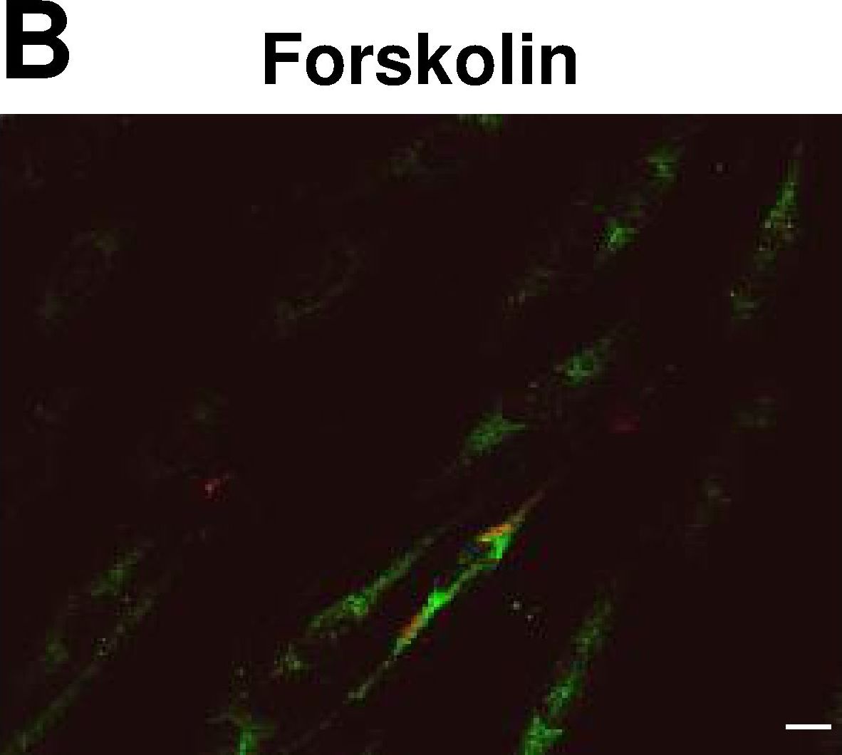 Cellular localization and associations of the major lipolytic proteins in human skeletal muscle at rest and during exercise.