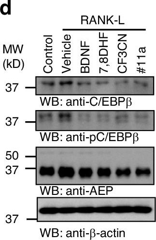 Fig.5.D showing Western Blotting in a Mus musculus (House mouse) sample from the publication: C/EBPβ dictates postmenopausal FSHβ transcription and blockade of AEP/C/EBPβ pathway alleviates osteoporosis.