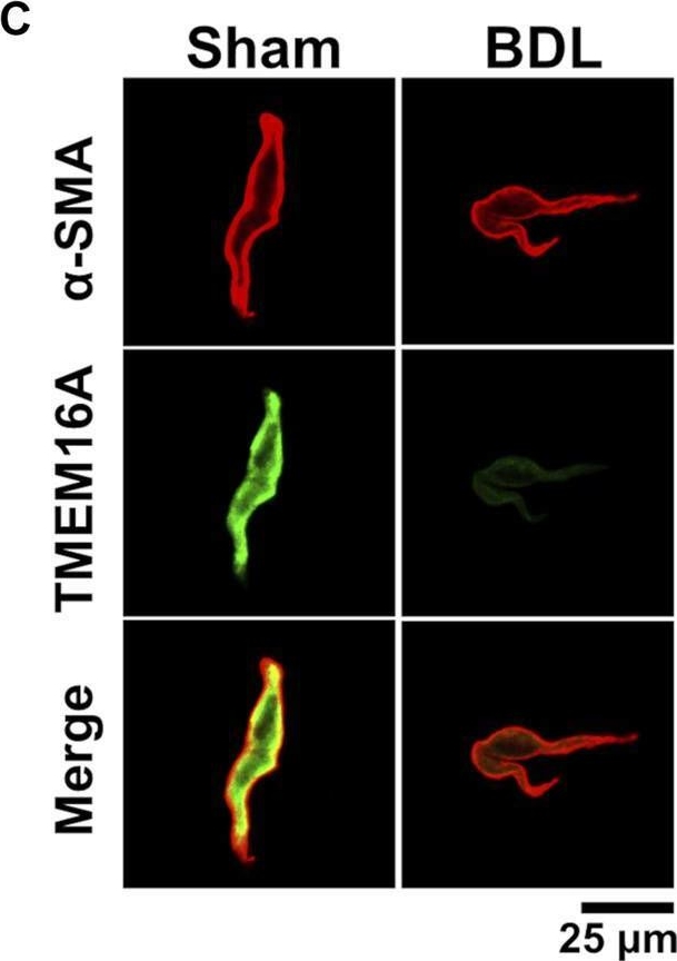Fig.2.C showing Immunocytochemistry-immunofluorescence in a Mus musculus (House mouse) sample from the publication: Downregulation of Ca2+-Activated Cl- Channel TMEM16A Mediated by Angiotensin II in Cirrhotic Portal Hypertensive Mice.