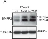 Fig.1.A showing Western Blotting from the publication: MnTBAP Reverses Pulmonary Vascular Remodeling and Improves Cardiac Function in Experimentally Induced Pulmonary Arterial Hypertension.