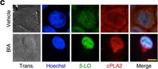 Fig.1.C showing Immunocytochemistry-immunofluorescence in a Homo sapiens (Human) sample from the publication: Leukotriene C4 is the major trigger of stress-induced oxidative DNA damage.